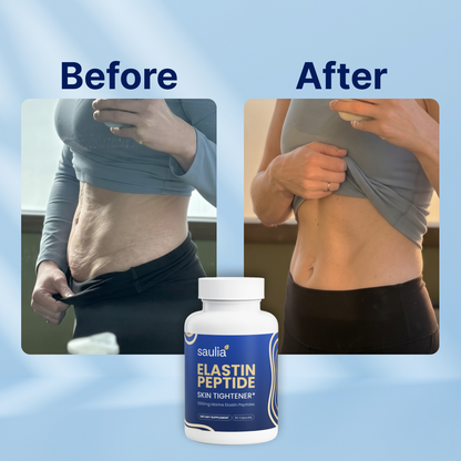 Elastin Peptide Skin Tightening Formula